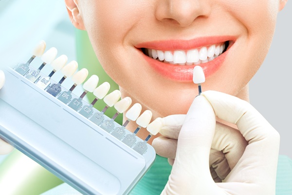 Tips To Keep Your Dental Veneers Looking Brand New