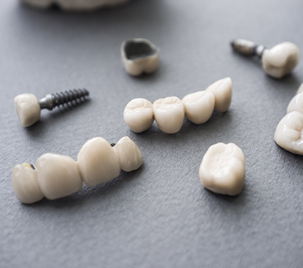 Cherry Hill The Difference Between Dental Implants and Mini Dental Implants
