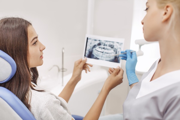 FAQs About Tooth Extractions